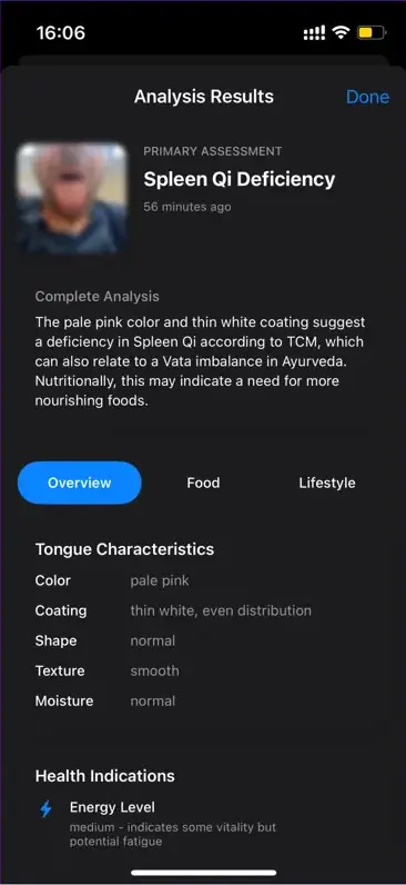 TongueAnalyzer app showing a thick white tongue coating analysis and guidance